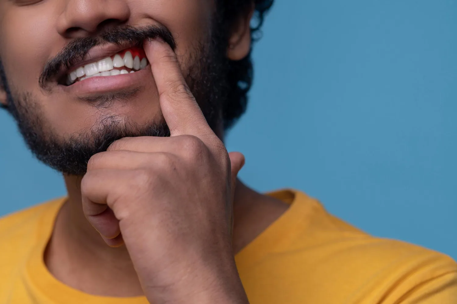 Gums